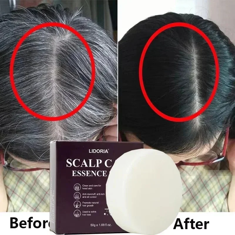 Gray White Hair Treatment Serum Soap Fast White To Black Repair Nourish Beard Hair Roots Shampoo Men Women Beauty Health Care
Gray White Hair Treatment Serum Soap Fast White To Black Repair Nourish Beard Hair Roots Shampoo Men Women Beauty Health Care