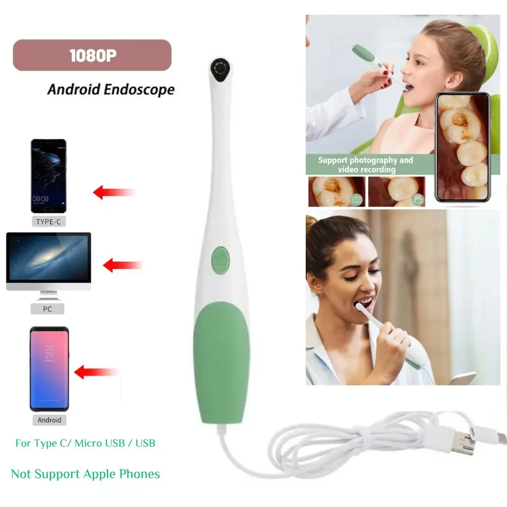 2MP HD Endoscope Camera Home Using Intraoral Skin Examination Tool for Android And PC
2MP HD Endoscope Camera Home Using Intraoral Skin Examination Tool for Android And PC