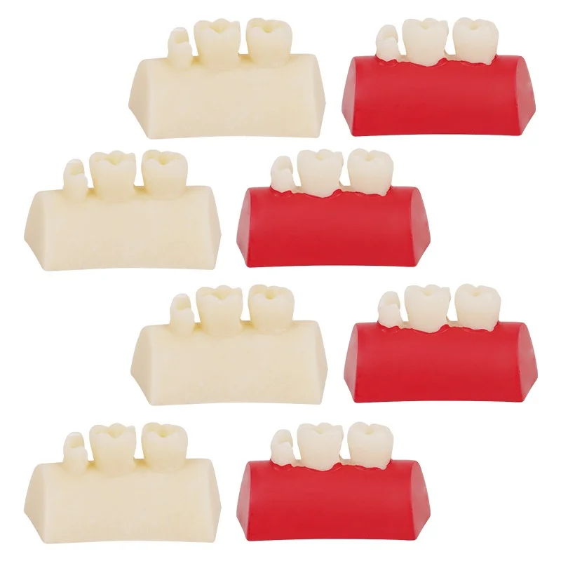 4pcs Dental Inlay Exercise Model Block Composite Resin Filling Practice Dentistry Oral Teeth Teaching Typodont Study Tool
4pcs Dental Inlay Exercise Model Block Composite Resin Filling Practice Dentistry Oral Teeth Teaching Typodont Study Tool