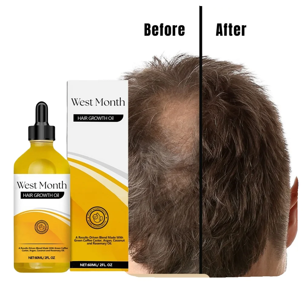 Rich and dense hair essential oil prevents hair loss, smooths and nourishes hair | strengthens hair care, making hair thicker
Rich and dense hair essential oil prevents hair loss, smooths and nourishes hair | strengthens hair care, making hair thicker