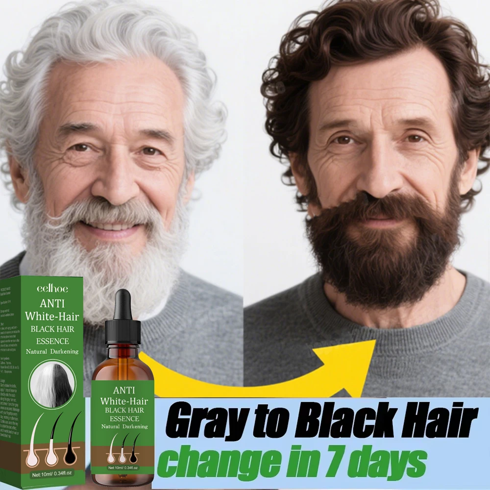 Gray To Black Hair Oil Reduces Premature Graying Nourishes Follicles Restores Natural Black Pigment Darkening Gray/white Hair
Gray To Black Hair Oil Reduces Premature Graying Nourishes Follicles Restores Natural Black Pigment Darkening Gray/white Hair