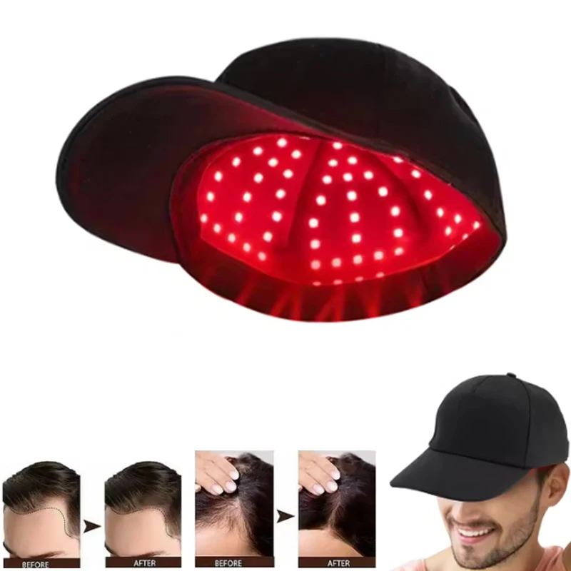 Новые 96 шт. инфракрасные светодиоды, терапия красным светом, 660 нм и 850 нм, шапочка для роста волос, против выпадения волос, расслабление, уход за кожей головы, шапка
Новые 96 шт. инфракрасные светодиоды, терапия красным светом, 660 нм и 850 нм, шапочка для роста волос, против выпадения волос, расслабление, уход за кожей головы, шапка