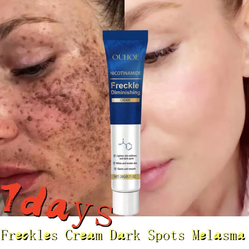 Face Dark Skin Brightening Cream Women Moisturizing Remove Melasma Cream Removal Chloasma Lighten Cream Fade Dull Brighten Care
Face Dark Skin Brightening Cream Women Moisturizing Remove Melasma Cream Removal Chloasma Lighten Cream Fade Dull Brighten Care
