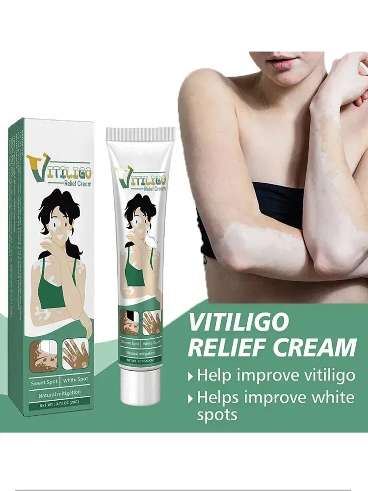 Organic Vitiligo Treatment Cream With Herbal Extract for White Spot Ringworm Removal
Organic Vitiligo Treatment Cream With Herbal Extract for White Spot Ringworm Removal