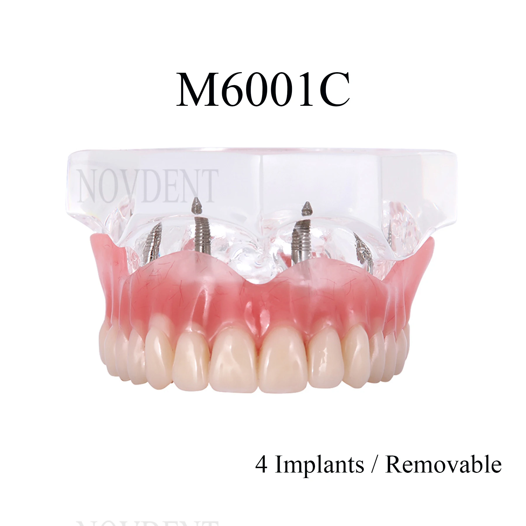 Dental Upper Jaw 4Implants Restoration Model Overdenture Model 4 Implants Bridges Teaching Education Research M6001C
Dental Upper Jaw 4Implants Restoration Model Overdenture Model 4 Implants Bridges Teaching Education Research M6001C