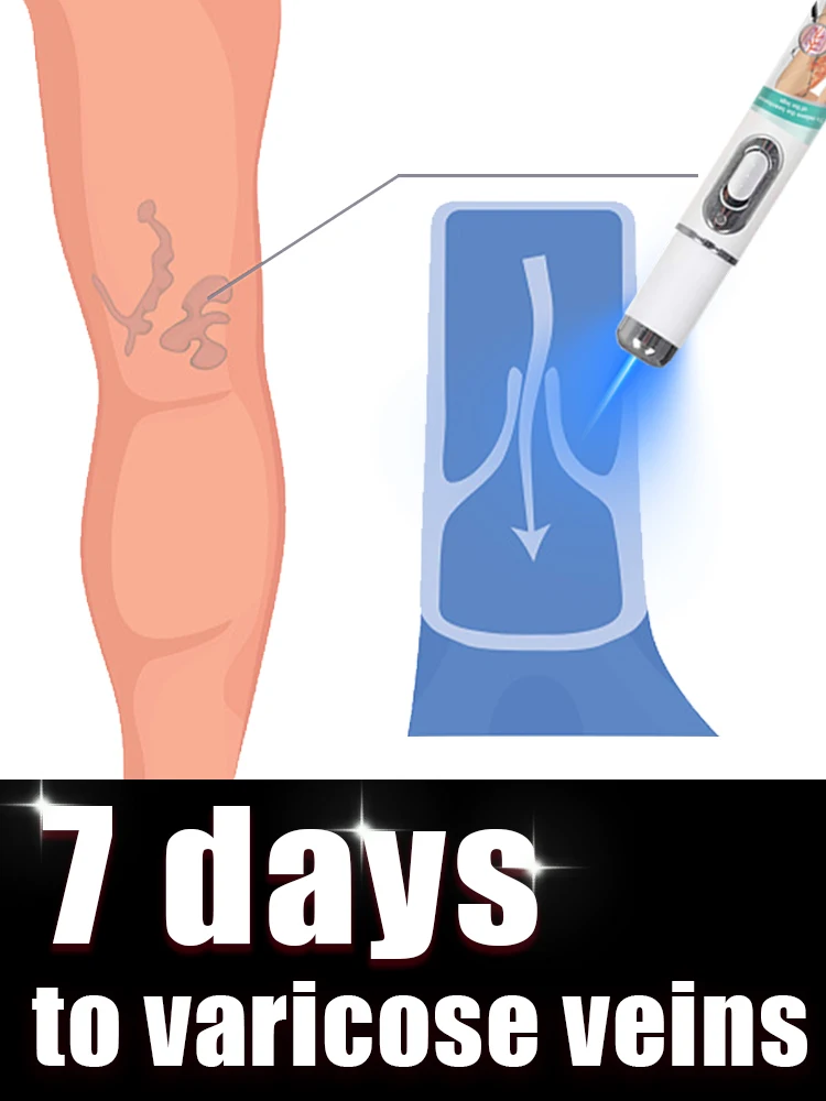 Инструменты для ухода за ногами улучшают функции venous valves, укрепляют venous walls и изготовление venous walls больше не слабый.
Инструменты для ухода за ногами улучшают функции venous valves, укрепляют venous walls и изготовление venous walls больше не слабый.