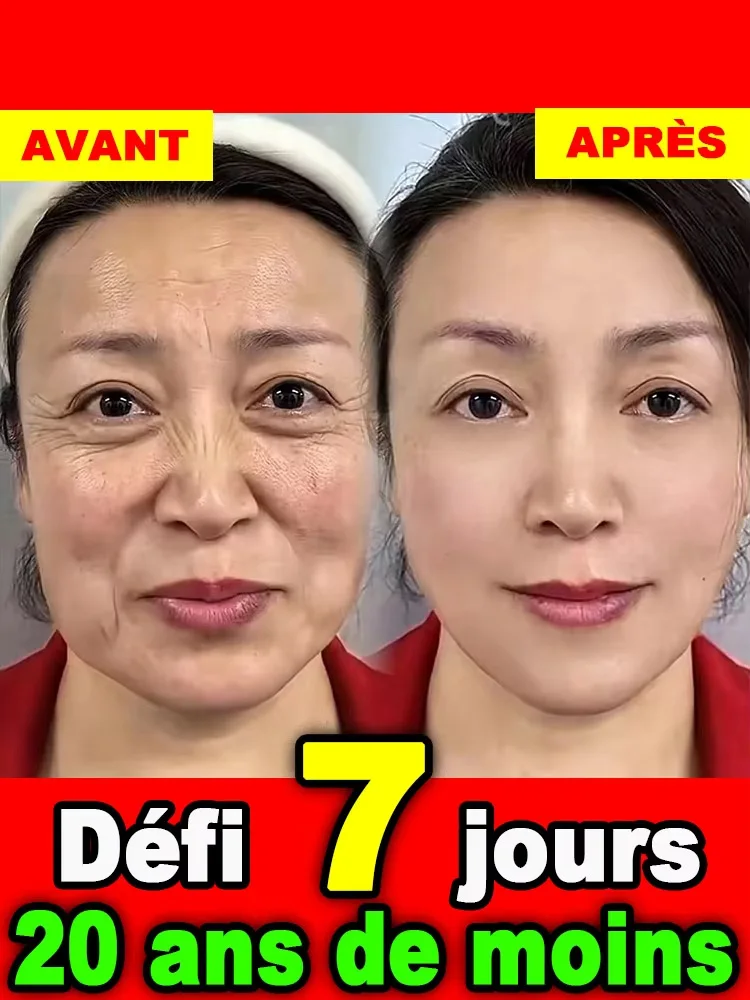 Collagen activated fetus, wrinkle lightening, filling milk, moisturizing and nourishing the skin
Collagen activated fetus, wrinkle lightening, filling milk, moisturizing and nourishing the skin