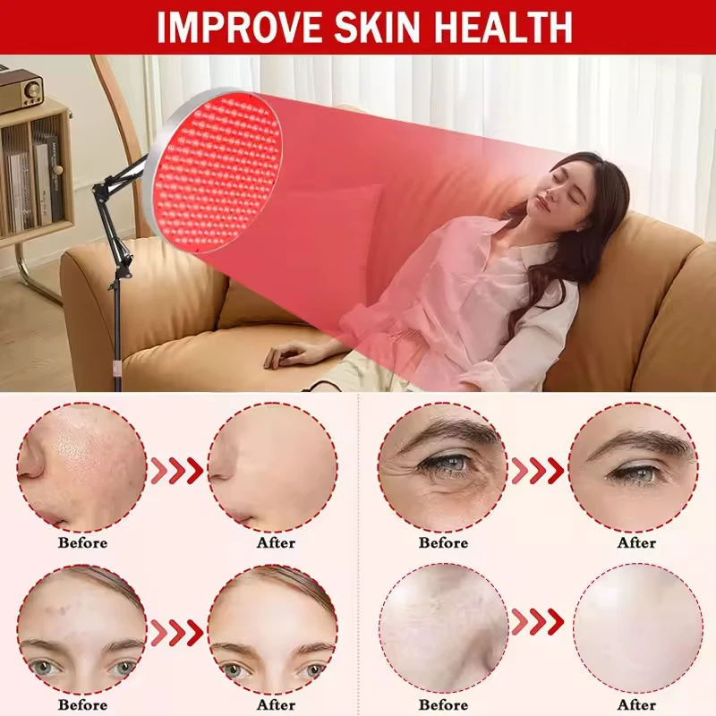 Светодиодная панель для красной светотерапии: лампа для омоложения кожи лица, 250 светодиодов, для снятия боли в теле, физиотерапевтический инструмент
Светодиодная панель для красной светотерапии: лампа для омоложения кожи лица, 250 светодиодов, для снятия боли в теле, физиотерапевтический инструмент
