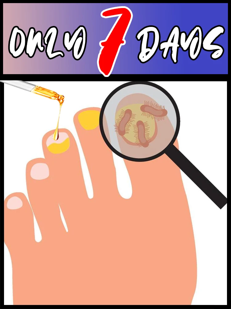 Смесь эфирных масел для густых и обесцвеченных ногтей, лечение ухода за ногтями чайного дерева, поддерживает прочность и четкость ногтей
Смесь эфирных масел для густых и обесцвеченных ногтей, лечение ухода за ногтями чайного дерева, поддерживает прочность и четкость ногтей