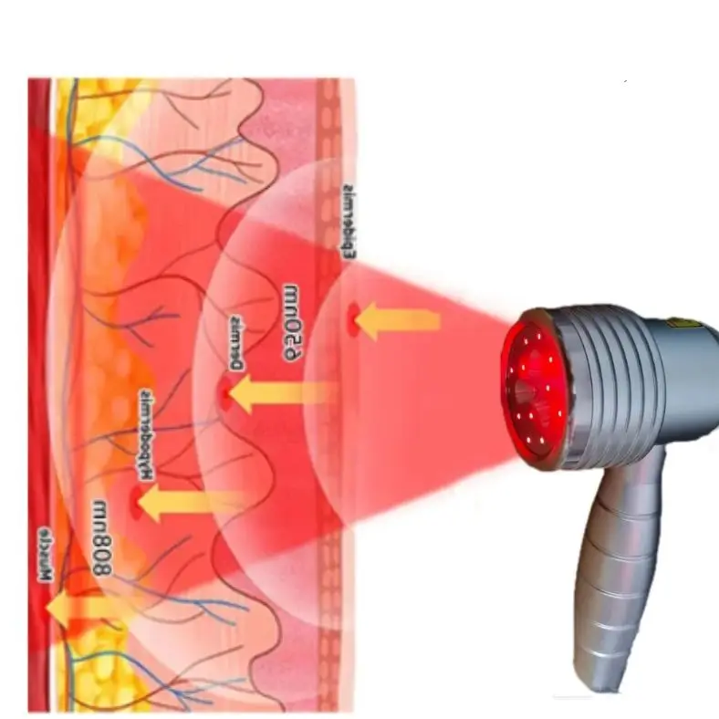 Portable Cold Laser Therapy Machine – 808nm Deep Tissue Penetration for Knee/Back Pain & Inflammation
Portable Cold Laser Therapy Machine – 808nm Deep Tissue Penetration for Knee/Back Pain & Inflammation