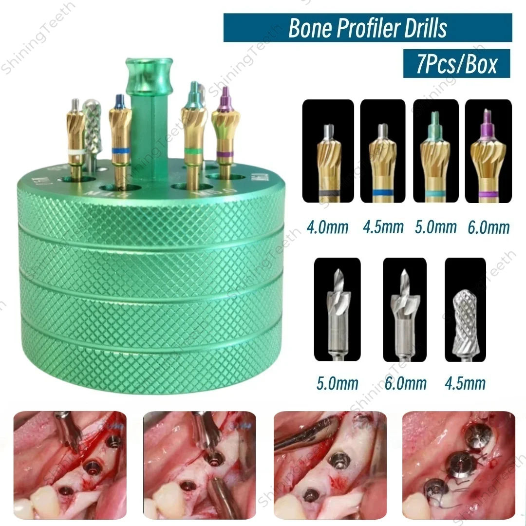 Набор шлифовальных боров для костного профиля зубного имплантата, универсальный набор с пилотной дрелью, триммер для контурирования костей, коллектор
Набор шлифовальных боров для костного профиля зубного имплантата, универсальный набор с пилотной дрелью, триммер для контурирования костей, коллектор