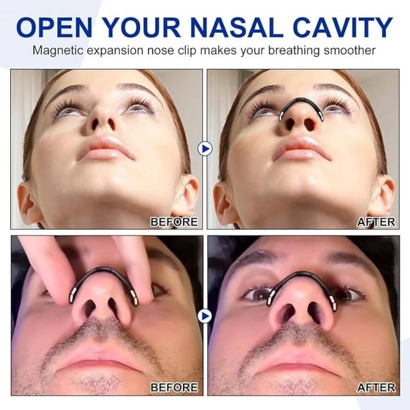Магнитные полоски для носа | Зупинити храп и повышение кислорода | Спорт и сон Лучшее дыхание | Безопасный для кожи назальный расширитель
Магнитные полоски для носа | Зупинити храп и повышение кислорода | Спорт и сон Лучшее дыхание | Безопасный для кожи назальный расширитель
