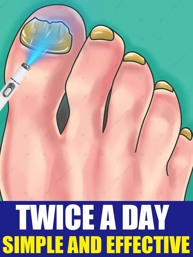 Скажи прощайте на онихомикоз, без вторжения, без повреждения ногтей.
Скажи прощайте на онихомикоз, без вторжения, без повреждения ногтей.