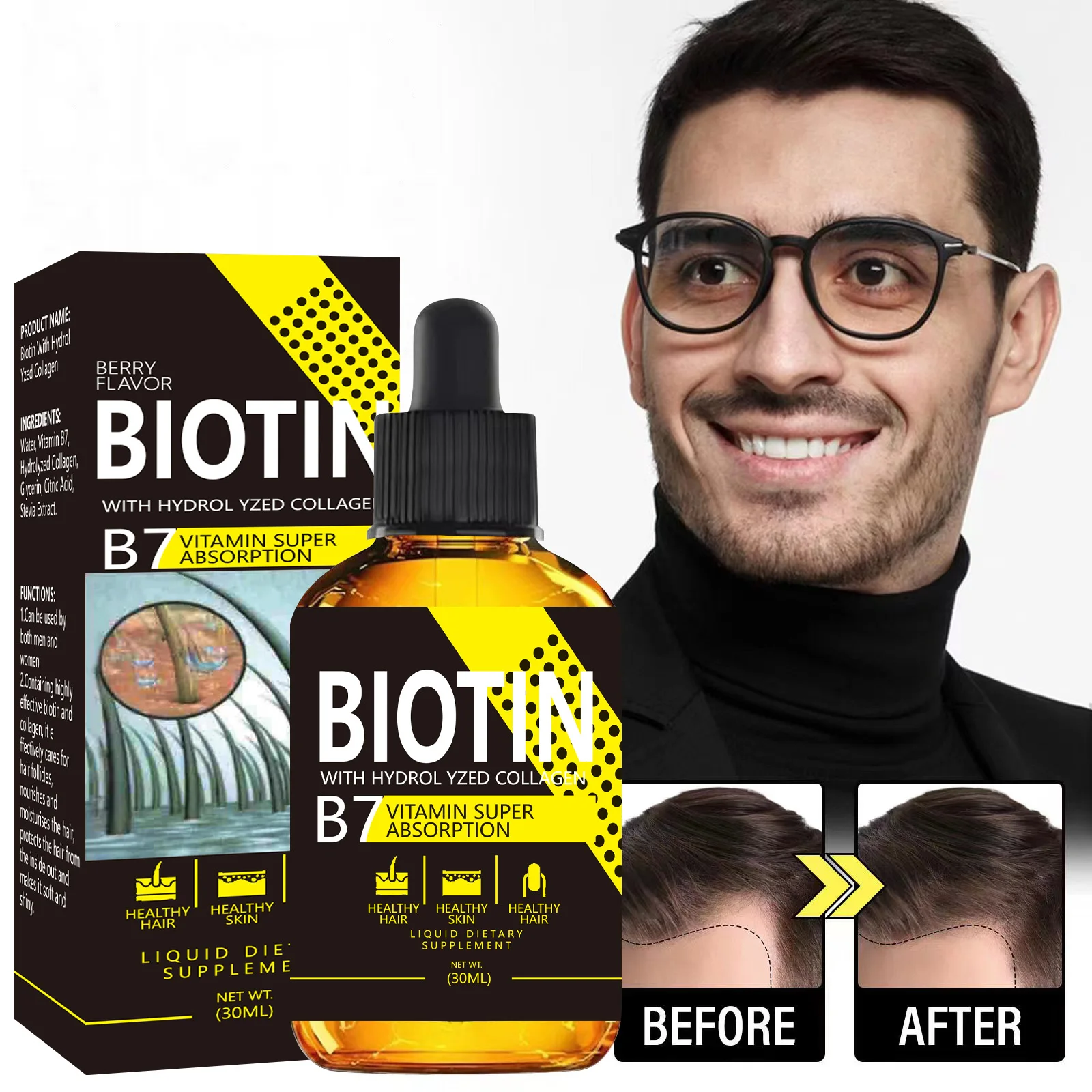 Биотин с эфирным маслом Hydrol Yzed Collagen B7 30 мл для улучшения корней волос, против выпадения волос
Биотин с эфирным маслом Hydrol Yzed Collagen B7 30 мл для улучшения корней волос, против выпадения волос