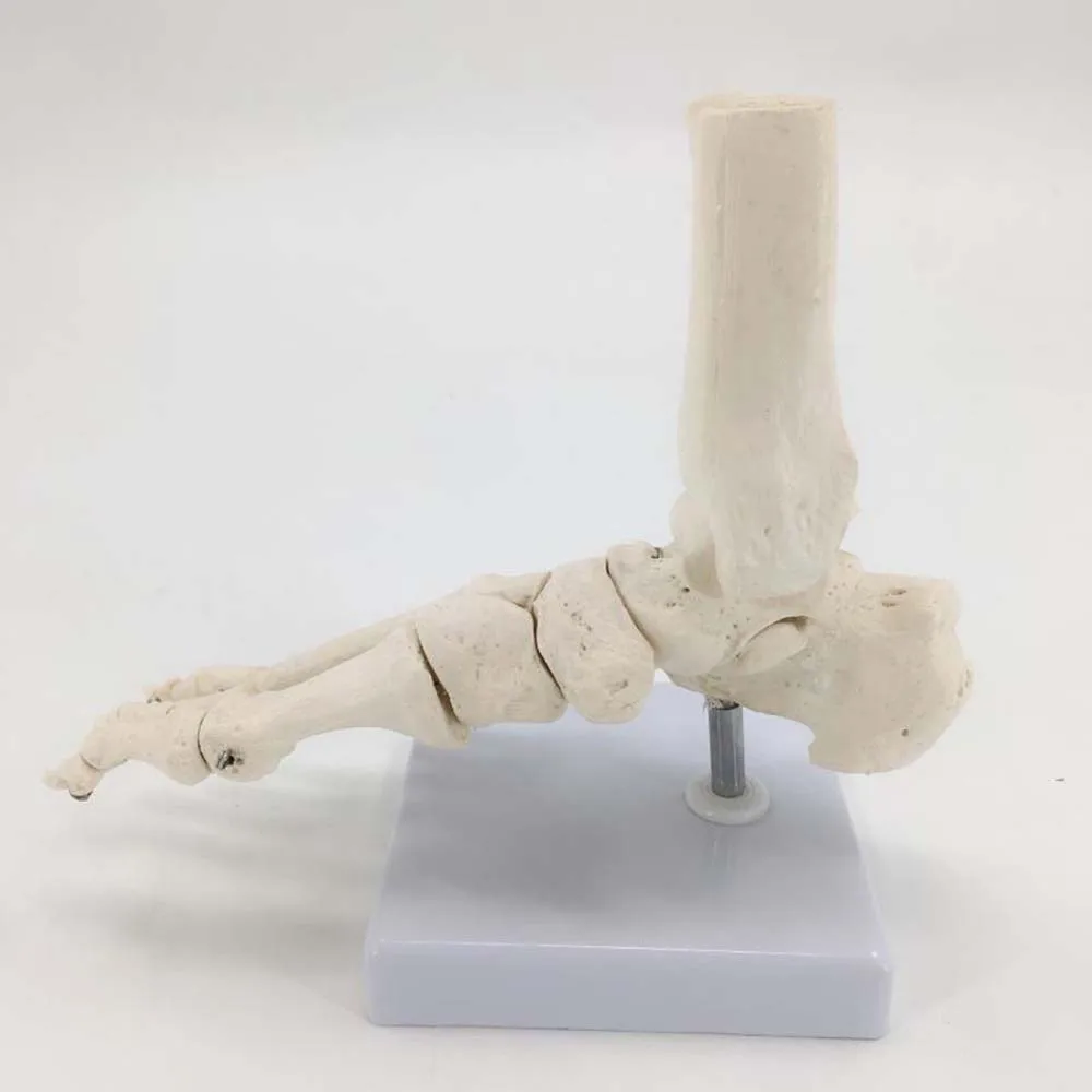 Human Foot Bone Model Foot Sole Joints of Foot Ankle Tibia and Fibula Foot Model Department of Orthopedics Teaching for Medical
Human Foot Bone Model Foot Sole Joints of Foot Ankle Tibia and Fibula Foot Model Department of Orthopedics Teaching for Medical