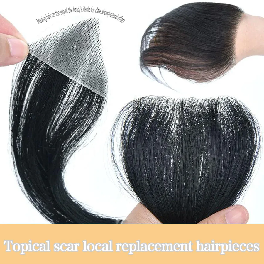 Synthetic Male and female biological scalp scar replacement patch, scalp alopecia areata burn scar small area wig patch
Synthetic Male and female biological scalp scar replacement patch, scalp alopecia areata burn scar small area wig patch