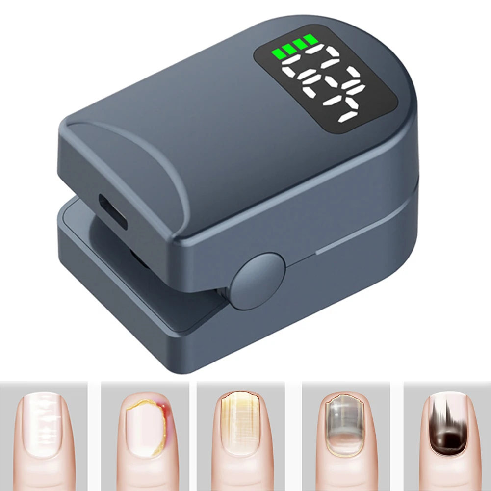 Nail Fungal Light Device Nail Fungal Eradication Device Portable 460nm Blue Light + 905nm Infrared Light for Nail Deformation
Nail Fungal Light Device Nail Fungal Eradication Device Portable 460nm Blue Light + 905nm Infrared Light for Nail Deformation
