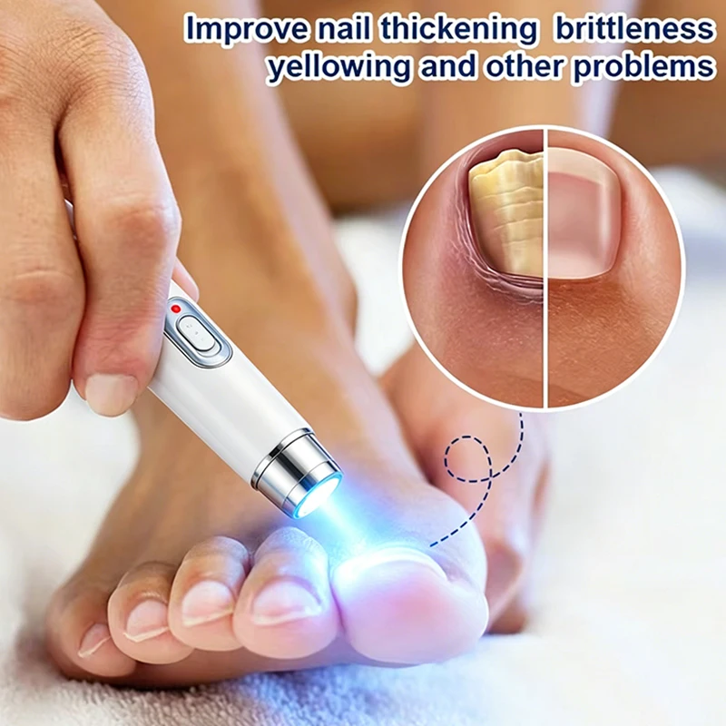 Diminish nail blemishes,refine maintenance
Diminish nail blemishes,refine maintenance
