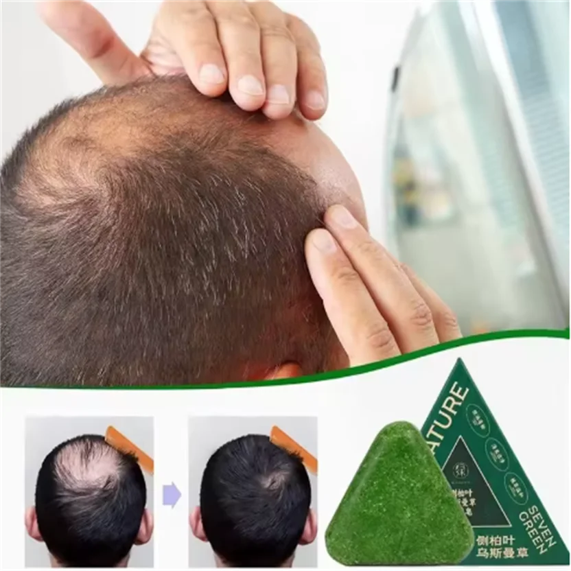 Polygonum multiflorum Cypress Leaf Usman Grass Shampoo Bar Gentle Shampoo Nourishing Oil Control Itching Soap Cleanses Scalp
Polygonum multiflorum Cypress Leaf Usman Grass Shampoo Bar Gentle Shampoo Nourishing Oil Control Itching Soap Cleanses Scalp