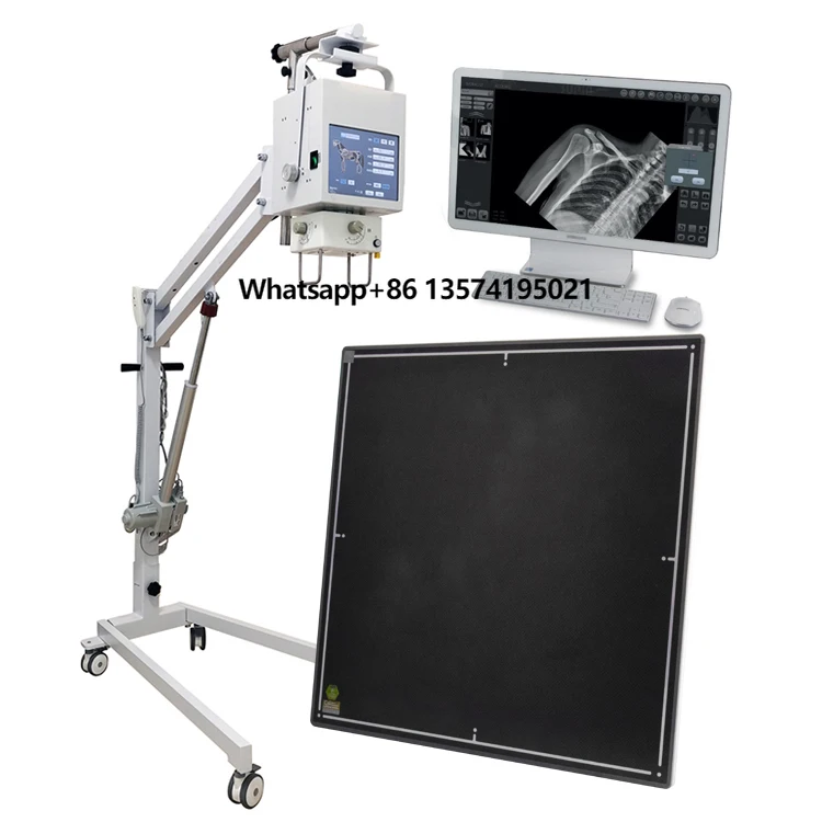 Hospital Radiography Equipment Careray 17"17 Digital Wireless Dr X Ray Flat Panel Detector
Hospital Radiography Equipment Careray 17"17 Digital Wireless Dr X Ray Flat Panel Detector