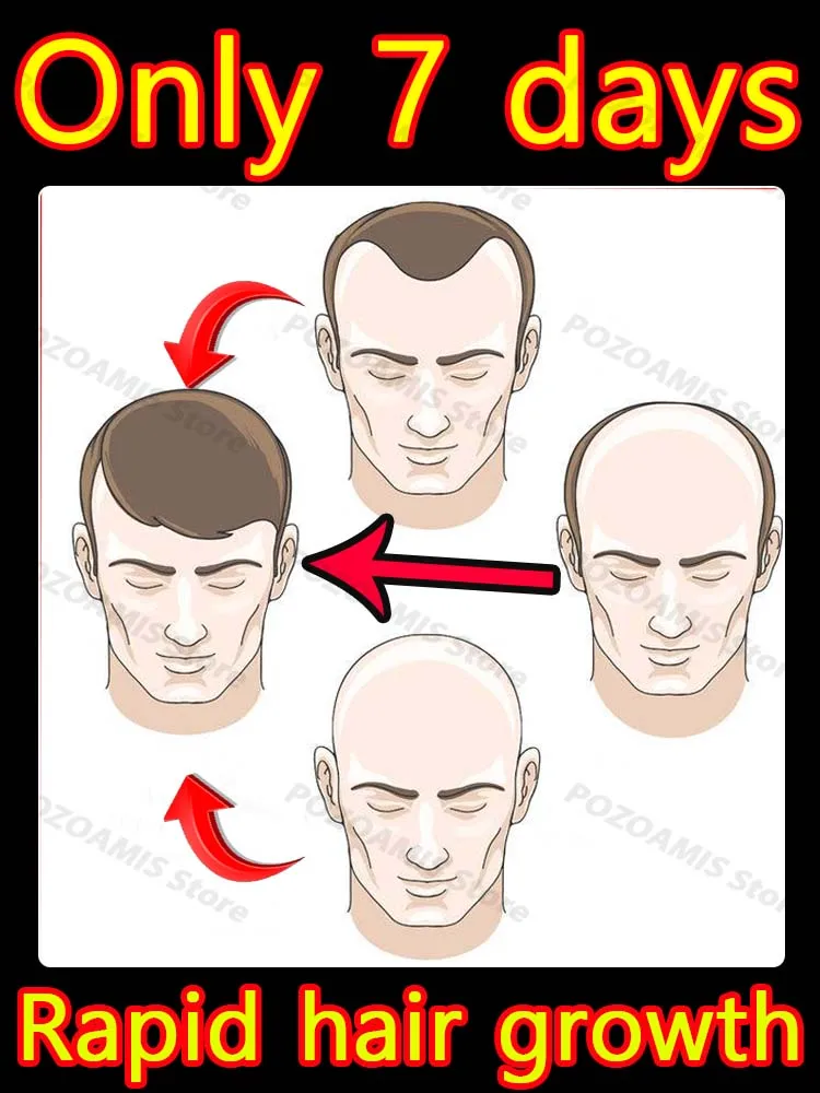 Экстракция чистого растительного эфирного масла, глубокое проникновение, пробуждение жизненной силы, безопасное и беспокойство
Экстракция чистого растительного эфирного масла, глубокое проникновение, пробуждение жизненной силы, безопасное и беспокойство