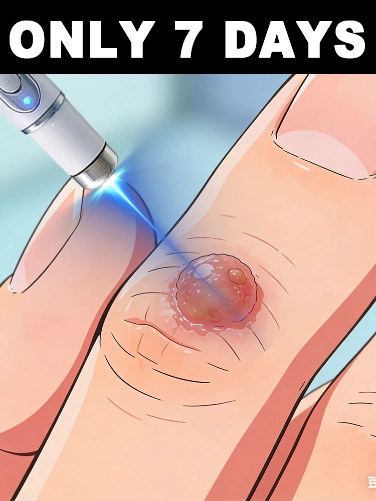 Precisely remove warts without leaving scars! ᴱᵃˢⁱˡʸ ʳᵉᵐᵒᵛᵉ ˢᵗᵘᵇᵇᵒʳⁿ ʷᵃʳᵗˢ ᵃᵗ ʰᵒᵐᵉ‧
Precisely remove warts without leaving scars! ᴱᵃˢⁱˡʸ ʳᵉᵐᵒᵛᵉ ˢᵗᵘᵇᵇᵒʳⁿ ʷᵃʳᵗˢ ᵃᵗ ʰᵒᵐᵉ‧