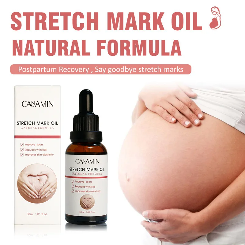 Крем от растяжек NATURALFORMULA с эфирными маслами для беременных женщин, для осветления и уменьшения растяжек
Крем от растяжек NATURALFORMULA с эфирными маслами для беременных женщин, для осветления и уменьшения растяжек