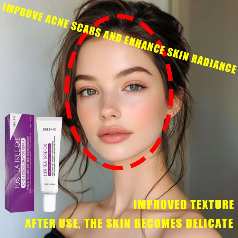 free Acne Removal Face Cream Anti-Acne CreamTreatment Acne Mark Skin Care Whitening Eliminate Pimples Facial Cream
free Acne Removal Face Cream Anti-Acne CreamTreatment Acne Mark Skin Care Whitening Eliminate Pimples Facial Cream