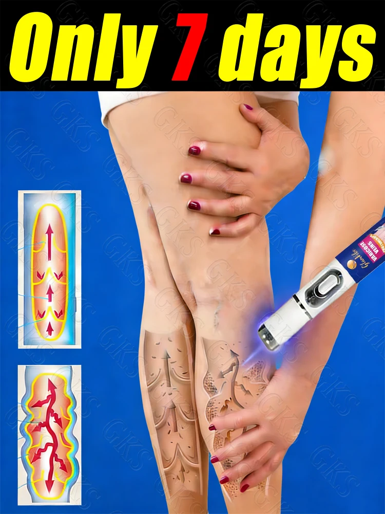 Скажи прощайте ноги-паука! Набор инструментов для ручки с синим светом, доступен для индивидуальной покупки или закупки.
Скажи прощайте ноги-паука! Набор инструментов для ручки с синим светом, доступен для индивидуальной покупки или закупки.