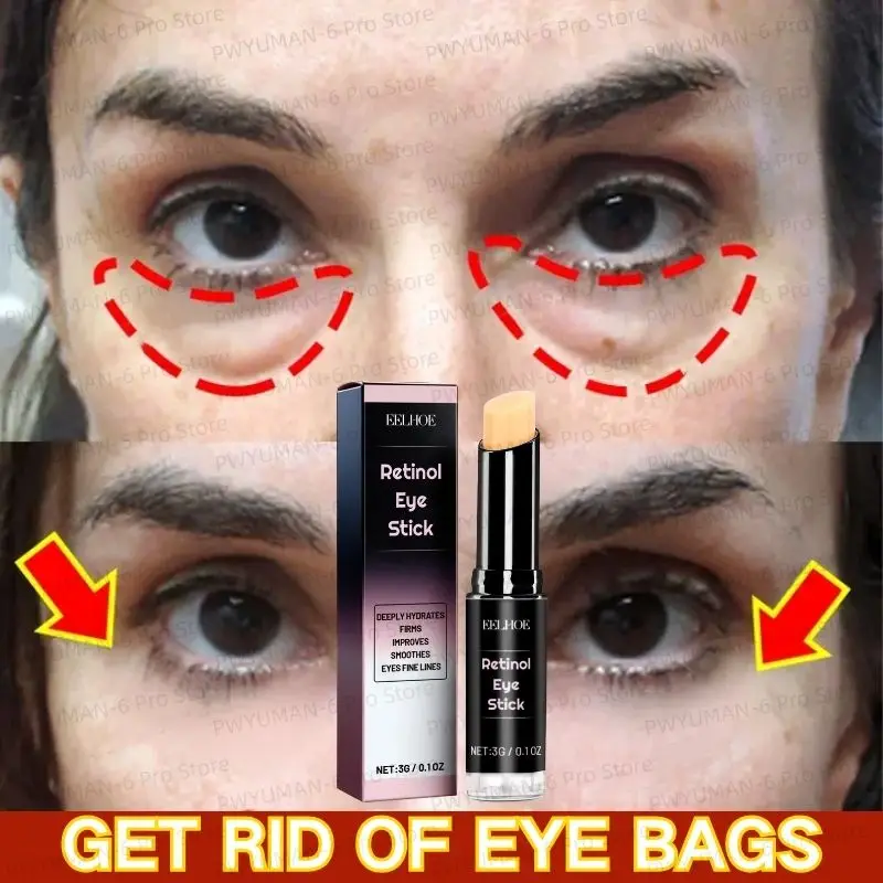 Instant Eye Bag Removal Cream Collagen Anti-Wrinkle Fade Fine Lines Firming Skin Anti Dark Circle Puffiness Brighten Eye Care
Instant Eye Bag Removal Cream Collagen Anti-Wrinkle Fade Fine Lines Firming Skin Anti Dark Circle Puffiness Brighten Eye Care