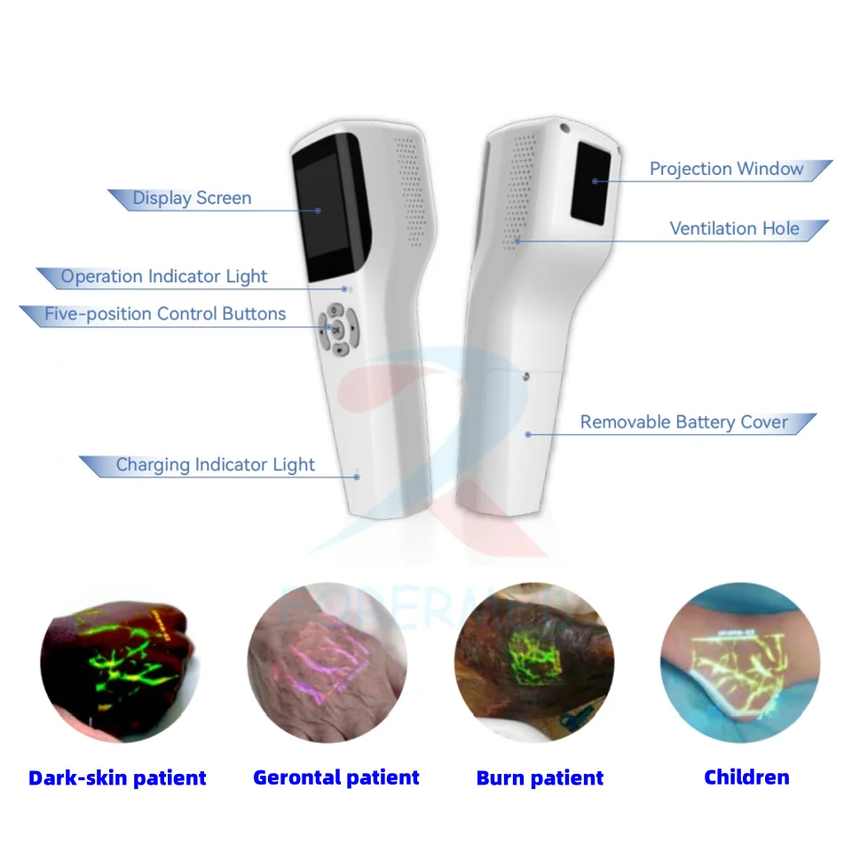 Medical 2.4'' Screen Infrared Blood Vessel Vein Finder Device Human Vet Infrared Vein Finder Portable Vein Finder Machine
Medical 2.4'' Screen Infrared Blood Vessel Vein Finder Device Human Vet Infrared Vein Finder Portable Vein Finder Machine