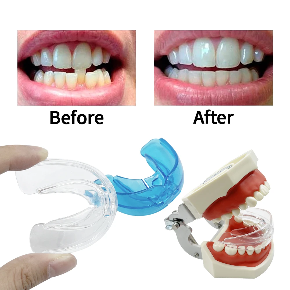 Orthodontic Braces Dental Braces Smile Teeth Alignment Trainer Instanted Silicone Teeth Retainer Mouth Guard Braces Tooth Tray
Orthodontic Braces Dental Braces Smile Teeth Alignment Trainer Instanted Silicone Teeth Retainer Mouth Guard Braces Tooth Tray