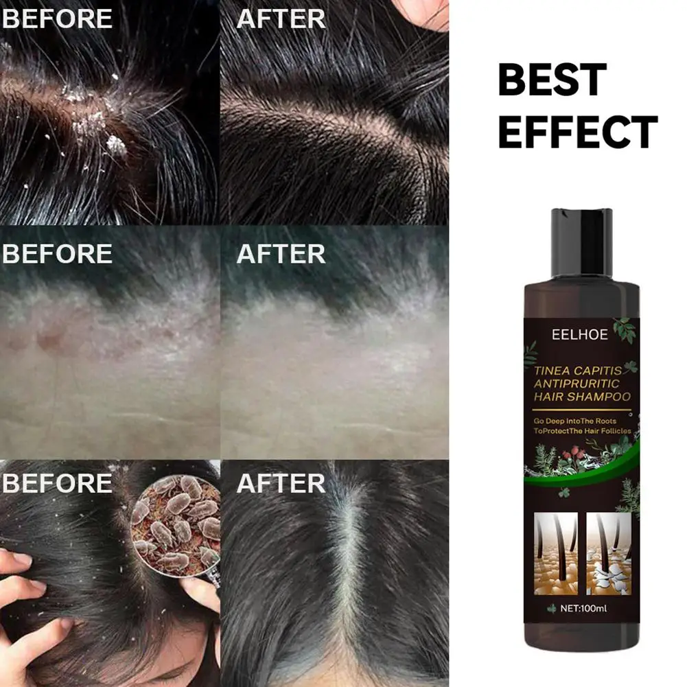 Anti Peeling Ginger Shampoo For Hair Fixation Repair Dry Damaged Anti Itching Oil Control Fluffy Hair Non Dew Enhancement X1Z8
Anti Peeling Ginger Shampoo For Hair Fixation Repair Dry Damaged Anti Itching Oil Control Fluffy Hair Non Dew Enhancement X1Z8