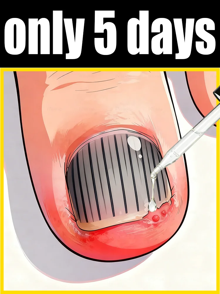 Hot cleaning nail brush tools, plastic vacuum cleaners, Say goodbye to nail troubles more discounts on sets24
Hot cleaning nail brush tools, plastic vacuum cleaners, Say goodbye to nail troubles more discounts on sets24