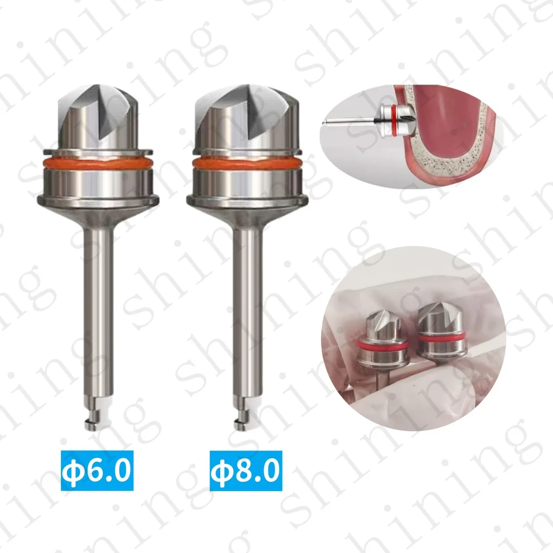 Dental Crestal Lateral Approach Reamer Sinus Lift Drill Cutting Alveolar φ6.0/8.0mm
Dental Crestal Lateral Approach Reamer Sinus Lift Drill Cutting Alveolar φ6.0/8.0mm