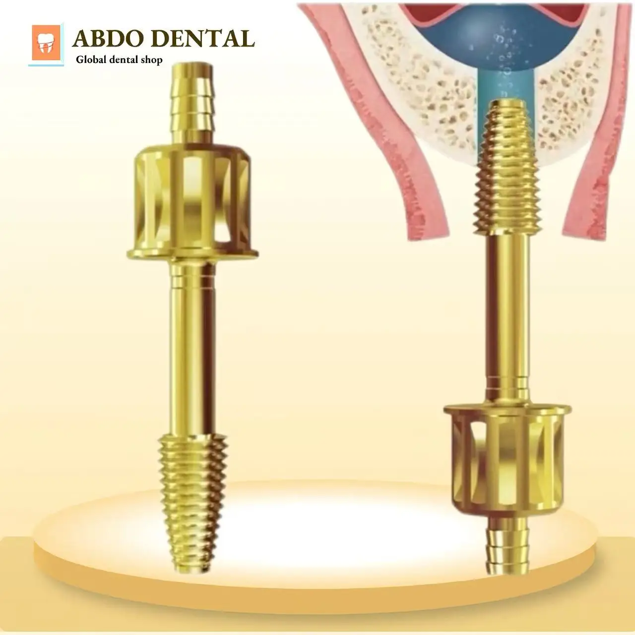 Dental Hydraulic Head Lifter Tip Gold Threaded Water Tip Leak-Proof Seal For Maxillary Implant Sinus Lifting Tool
Dental Hydraulic Head Lifter Tip Gold Threaded Water Tip Leak-Proof Seal For Maxillary Implant Sinus Lifting Tool
