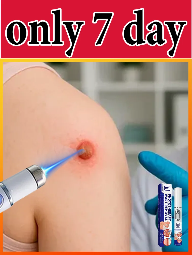 Gᴇɴᴇʀᴀᴛɪᴏɴ-3 Lᴀsᴇʀ Sᴀʏs Gᴏᴏᴅʙʏᴇ Tᴏ Wᴀʀᴛs Iɴ 7 Dᴀʏs
Gᴇɴᴇʀᴀᴛɪᴏɴ-3 Lᴀsᴇʀ Sᴀʏs Gᴏᴏᴅʙʏᴇ Tᴏ Wᴀʀᴛs Iɴ 7 Dᴀʏs