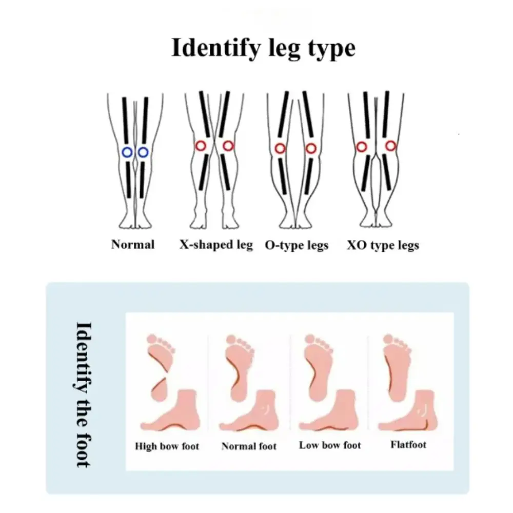 Breathable Material Arch Support Insoles Soft Comfortable Foot Correction Orthopedic Insoles Shock Absorption
Breathable Material Arch Support Insoles Soft Comfortable Foot Correction Orthopedic Insoles Shock Absorption