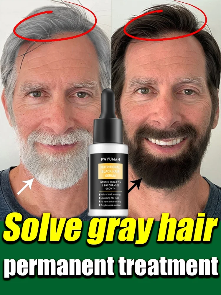 Natural Anti Gray Hair Serum - Repair White & Darkening Hair | Nourishing Hair Care Remedy
Natural Anti Gray Hair Serum - Repair White & Darkening Hair | Nourishing Hair Care Remedy
