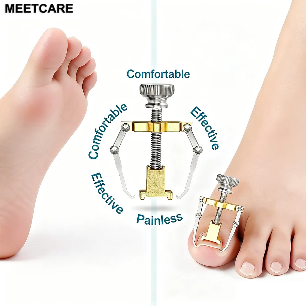 Ingrown Toenails correction pedicure foot toe nail care tools file Elastic Patch Straightening Clip Brace corrector Wire Fixer
Ingrown Toenails correction pedicure foot toe nail care tools file Elastic Patch Straightening Clip Brace corrector Wire Fixer
