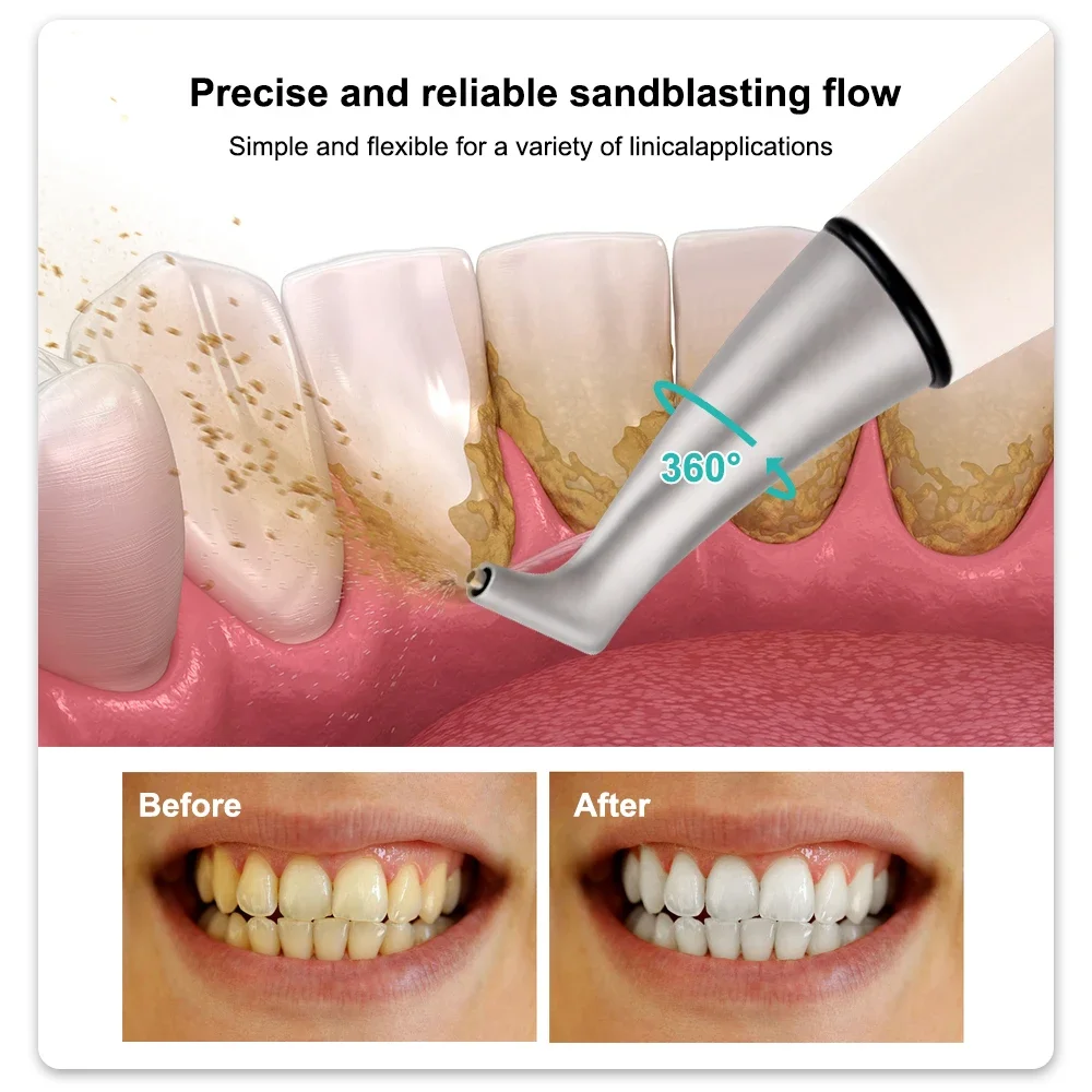 ELIJAH Dental Teeth Sandblasting Polishing Unit Air Flow Prophy Jet Handpiece Whitening Spray Teeth Polishing Dentistry Tools
ELIJAH Dental Teeth Sandblasting Polishing Unit Air Flow Prophy Jet Handpiece Whitening Spray Teeth Polishing Dentistry Tools