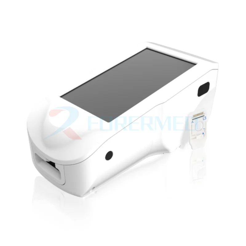 Medical Portable Palm Dry Electrolyte Analyzer Handheld Dry electrochemical LAB 5 in 1 Dry Electrolyte Analyzer
Medical Portable Palm Dry Electrolyte Analyzer Handheld Dry electrochemical LAB 5 in 1 Dry Electrolyte Analyzer