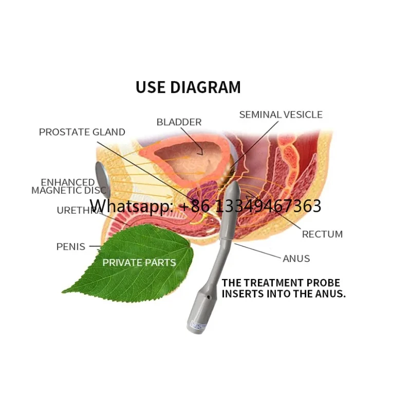 Manufacturer Magnetic Therapy Device for Prostatitis Fast Shipping
Manufacturer Magnetic Therapy Device for Prostatitis Fast Shipping