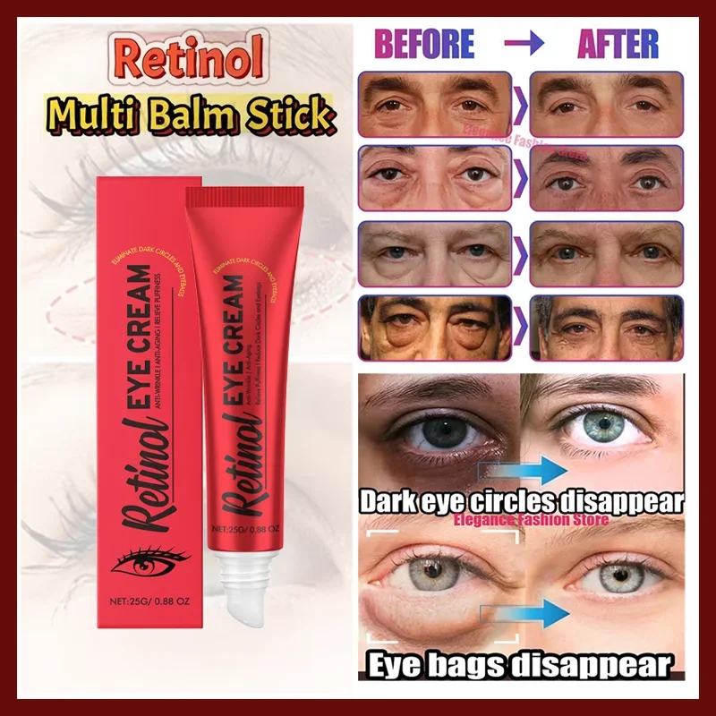 Instant Firming Eye Cream Firming Skin Around Eyes Reduce Dark Circles Eye
Instant Firming Eye Cream Firming Skin Around Eyes Reduce Dark Circles Eye