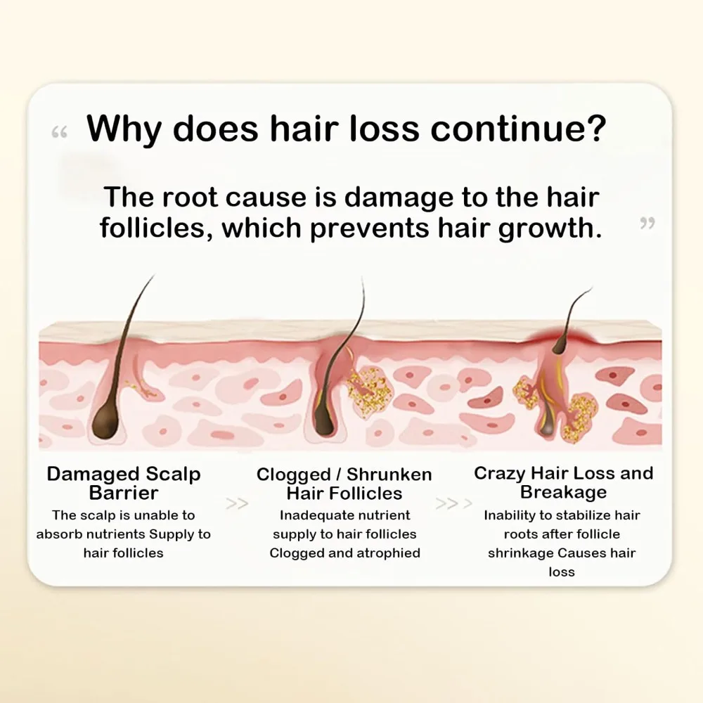 Hair Thickening Ginger Plant Extract Shampoo Deep Cleansing Replenish Hydration Anti-Hair Loss Hair Shampoo Promotes Hair Growth
Hair Thickening Ginger Plant Extract Shampoo Deep Cleansing Replenish Hydration Anti-Hair Loss Hair Shampoo Promotes Hair Growth