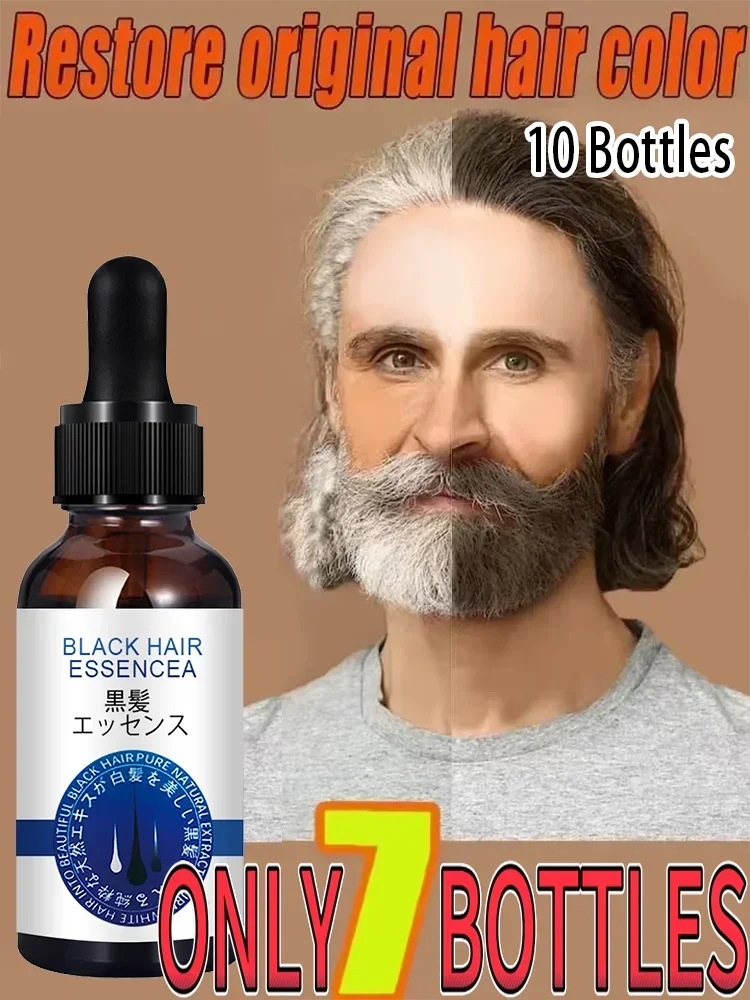 Healthy White To Black hair Anti-grey hair essence Serum treatment restore quickly turns white ahair into black naturalcolor7
Healthy White To Black hair Anti-grey hair essence Serum treatment restore quickly turns white ahair into black naturalcolor7