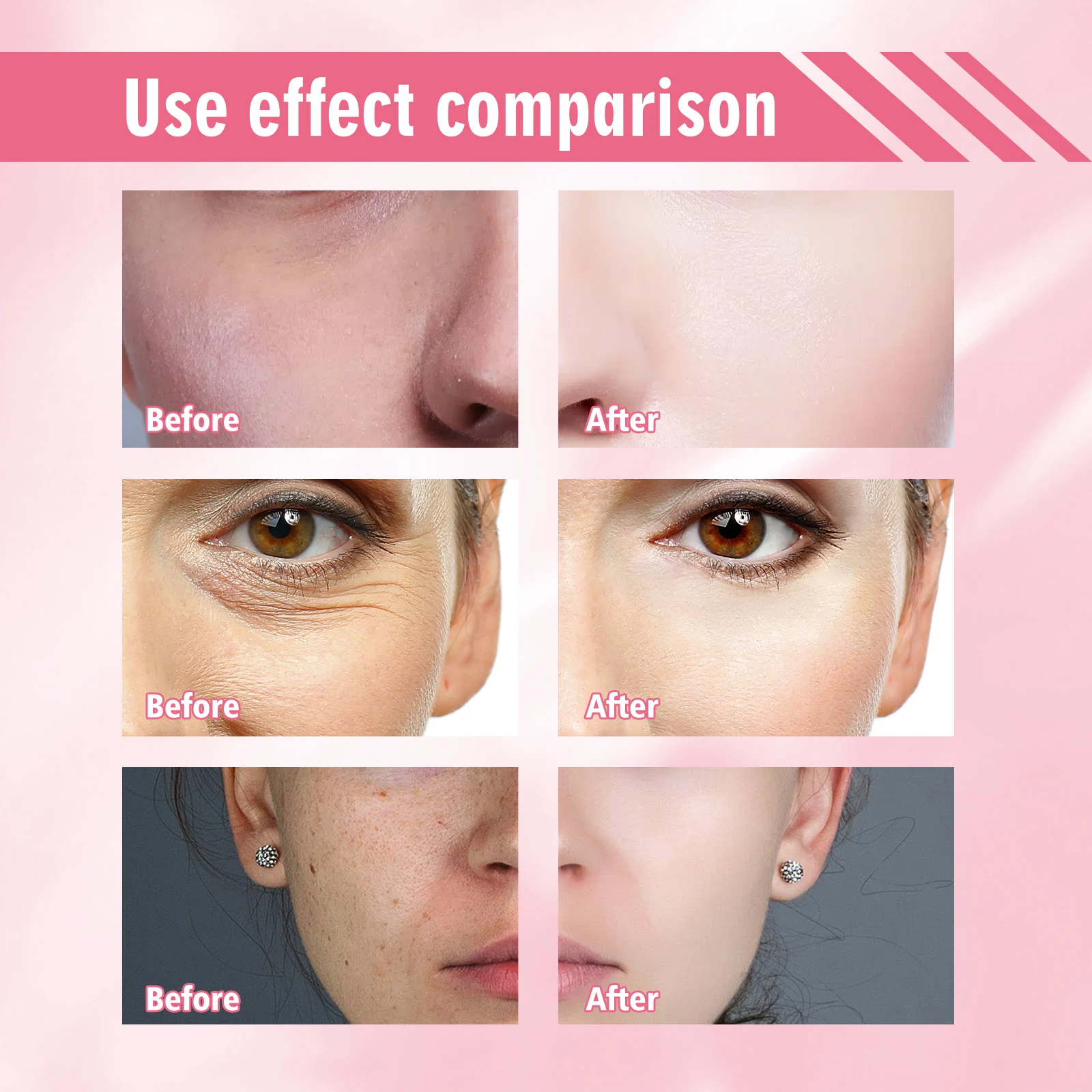 Jaysuing Blemish Whitening Serum Moisturizes Removes Dark Spots Lightens Lines And Brightens Skin Serum 3pcs
Jaysuing Blemish Whitening Serum Moisturizes Removes Dark Spots Lightens Lines And Brightens Skin Serum 3pcs