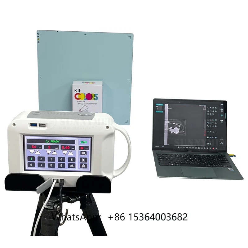 SY-D034 Portable X Ray Device Hospital Digital X-ray Machine for Human and Animal Use
SY-D034 Portable X Ray Device Hospital Digital X-ray Machine for Human and Animal Use