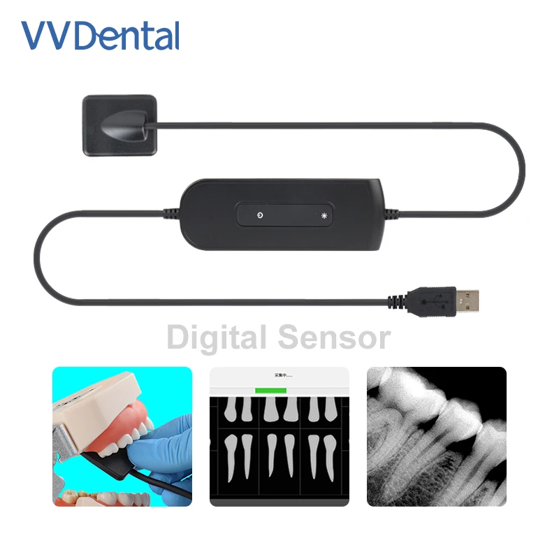 Dental X-Ray Imaging System Sensor Digital Portable for Rapid Oral Exam on Children & Adults in Clinics - Easy to Use
Dental X-Ray Imaging System Sensor Digital Portable for Rapid Oral Exam on Children & Adults in Clinics - Easy to Use