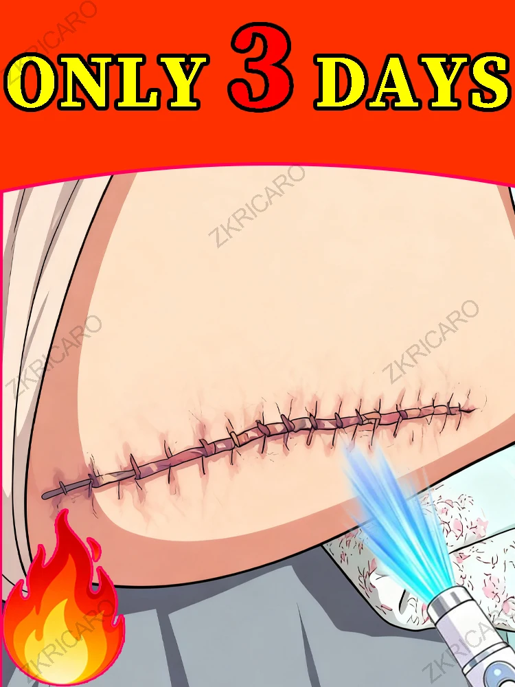 Шрамы действительно ушла!
Шрамы действительно ушла!